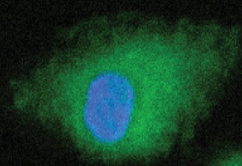 Dendritic cell showing TLR7 (green) and the nucleus (blue). Excessive activation of the TLR7 inflammatory pathway has been linked to the development of lupus.