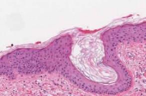IRP researchers discovered the reason that skin tissue (pictured above) heals more slowly than tissue in the mouth.