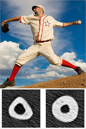 A baseball pitcher throwing with cross-sections underneath of bigger bone under the throwing arm and smaller bone under the non-throwing arm.