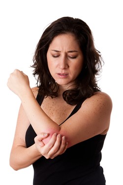 Woman holding elbow in pain