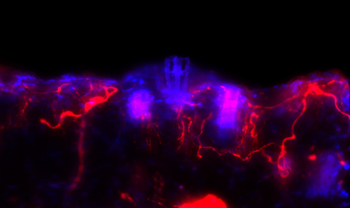 Activated BRAF (represented in red), when introduced into sensory nerve cells in mouse skin, triggers the itch sensation. Credit: Zhou-Feng Chen, Ph.D., Washington University in St. Louis.