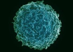 Colorized scanning electron micrograph of a B cell from a human donor