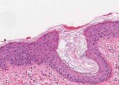 IRP researchers discovered the reason that skin tissue (pictured above) heals more slowly than tissue in the mouth.