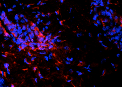 immune cells (red) in skin from the sclerodermic mice