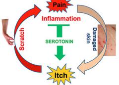 Scratching an itch causes minor pain which prompts the brain to release serotonin. But serotonin also reacts with receptors on neurons that carry itch signals to the brain making itching worse.
