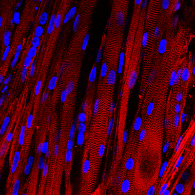 microscopic view of lab-grown human muscle bundles