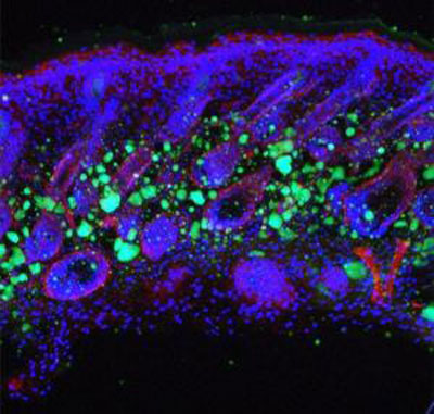a microscopic image of the skin, showing skin cells stained blue and fat cells stained green