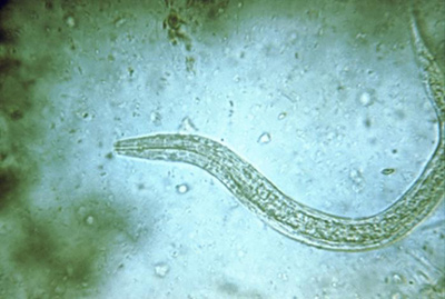 Photo of a helminth worm.
