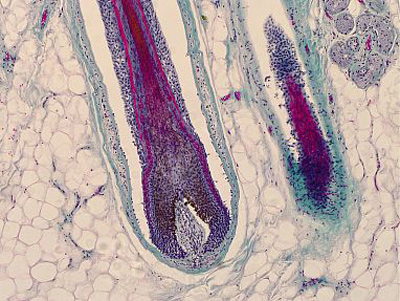Melanocyte stem cells are found within hair follicles