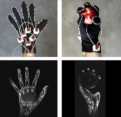 A glove is being developed to enable MRI scans of a moving hand