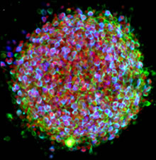 iPS cell cluster