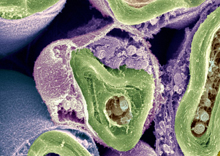 yelin (green) encases and protects nerve fibers (brown). A new technique prevents the immune system from attacking myelin in a mouse model of multiple sclerosis. Credit: Dr David Furness, Wellcome Images. All rights reserved by Wellcome Images.